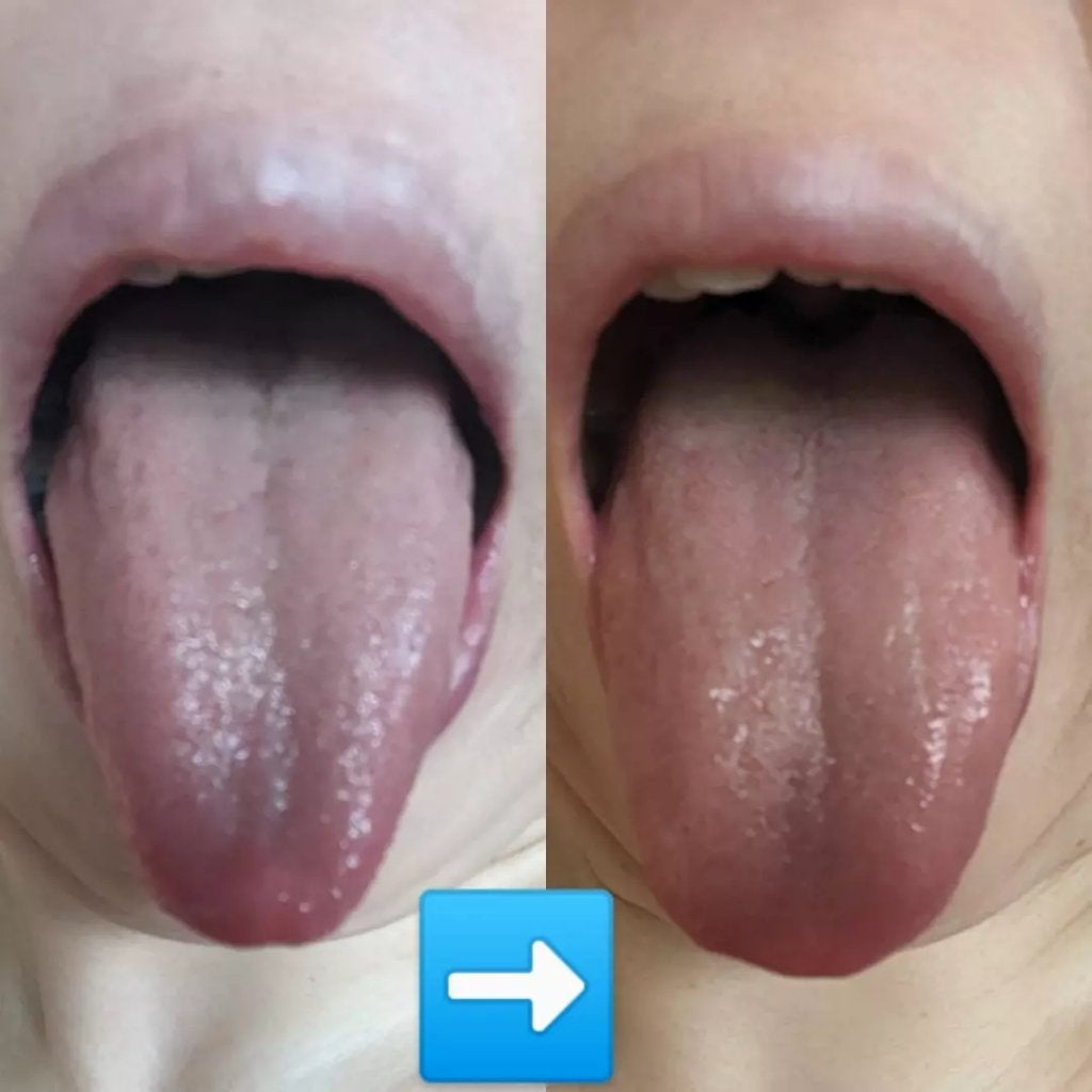 おほあんどうふ on LIPS 「取れ~る🎶取れる❣️食べたものの臭いのするアカみたいな物が取れ..」(2枚目)