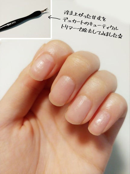 キューティクルトリマー/デュカート/ネイル用品を使ったクチコミ(4枚目)