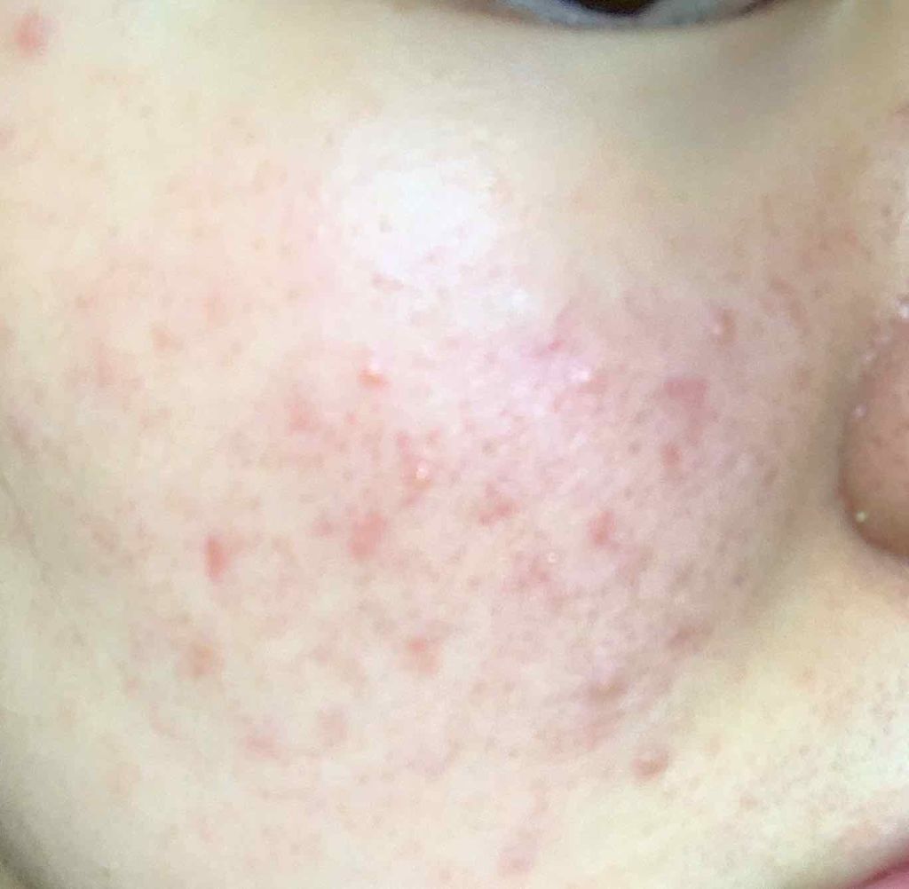 bebe on LIPS 「.*・゚4日目.゚・*.投稿する度悲しくなってきた、、、きれい..」(3枚目)