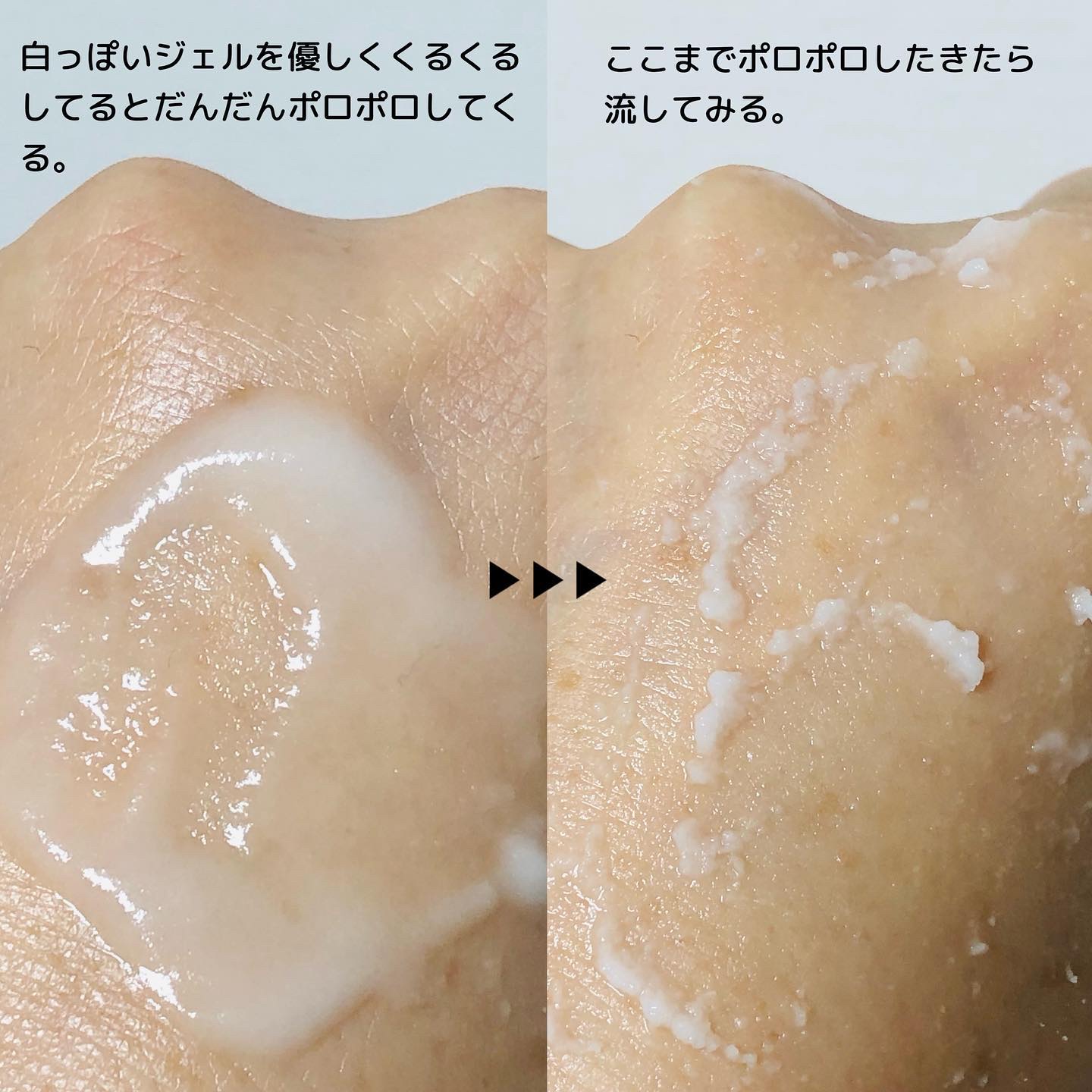 ブライトニングピーリングジェル/Dr.G/ピーリングを使ったクチコミ（2枚目）