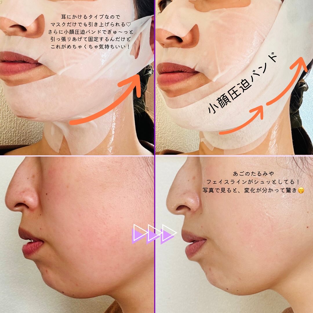 9番 NMNバイオリフトラッピングマスク/numbuzin/シートマスク・パックを使ったクチコミ（3枚目）