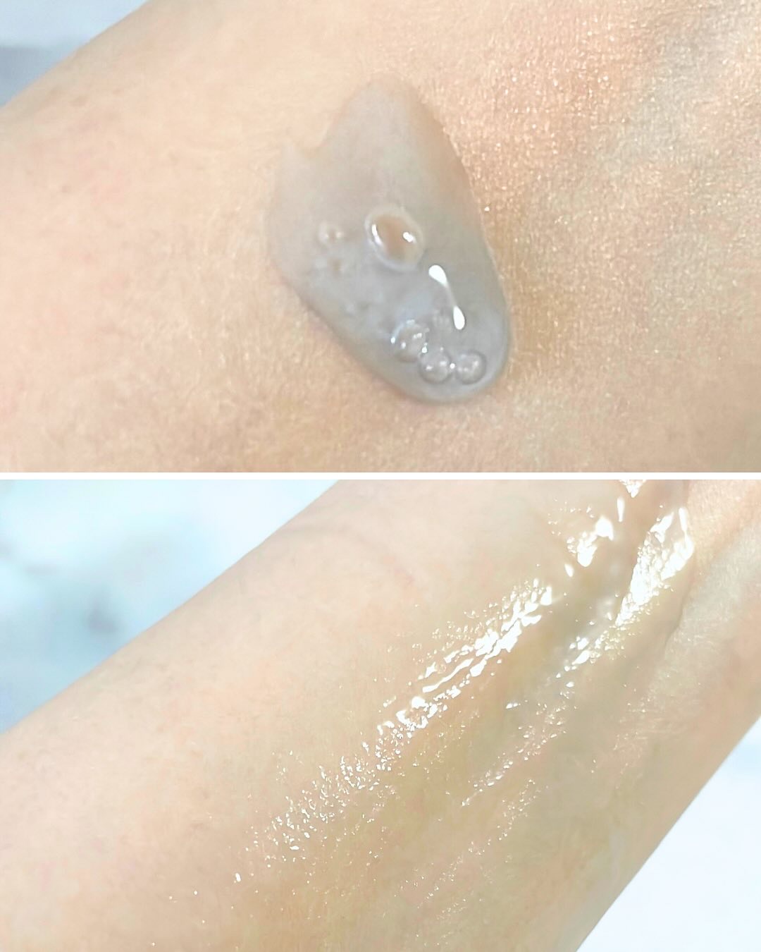 ニードルセラムAZ/fractionalCC/美容液を使ったクチコミ（2枚目）