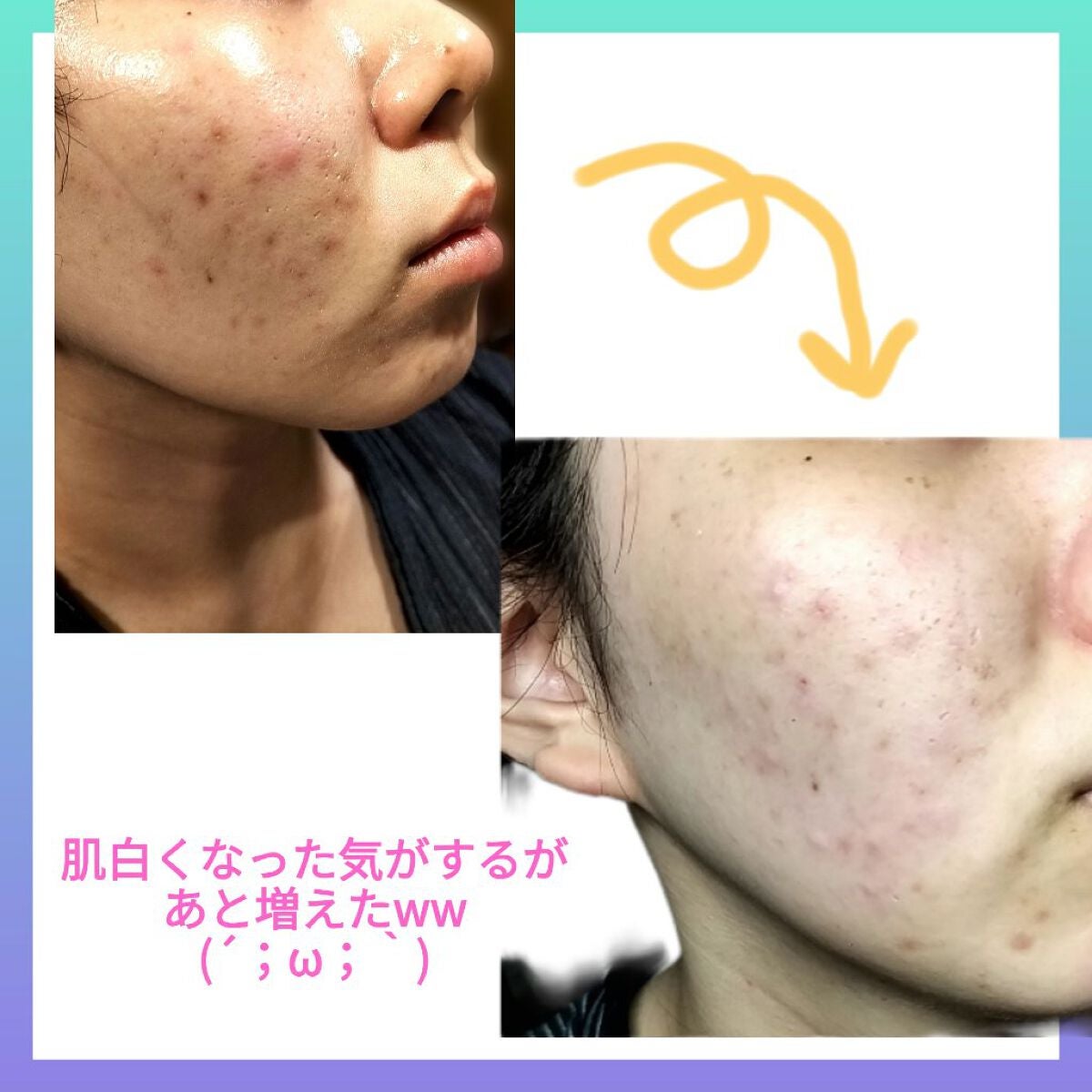 ケシミン浸透化粧水 しっとりタイプ/ケシミン/化粧水を使ったクチコミ(2枚目)