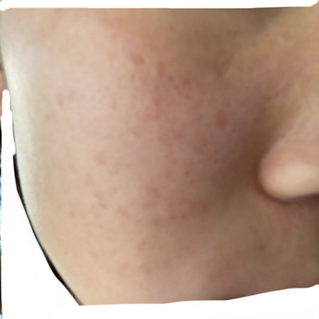 を使ったクチコミ（1枚目）