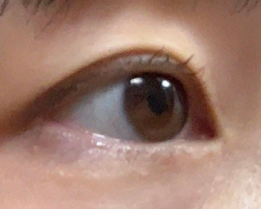 メザイク イージークリア 接着クリアタイプ/メザイク/二重まぶた用アイテムを使ったクチコミ(1枚目)