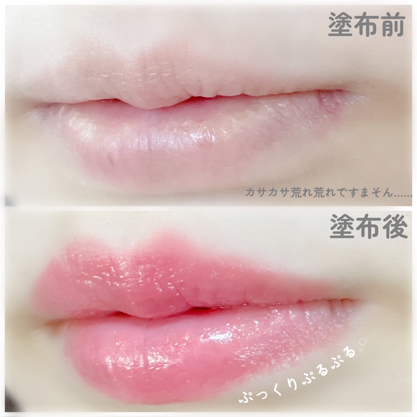 ドトムリッププラスプランパー/keybo/リッププランパーを使ったクチコミ(3枚目)