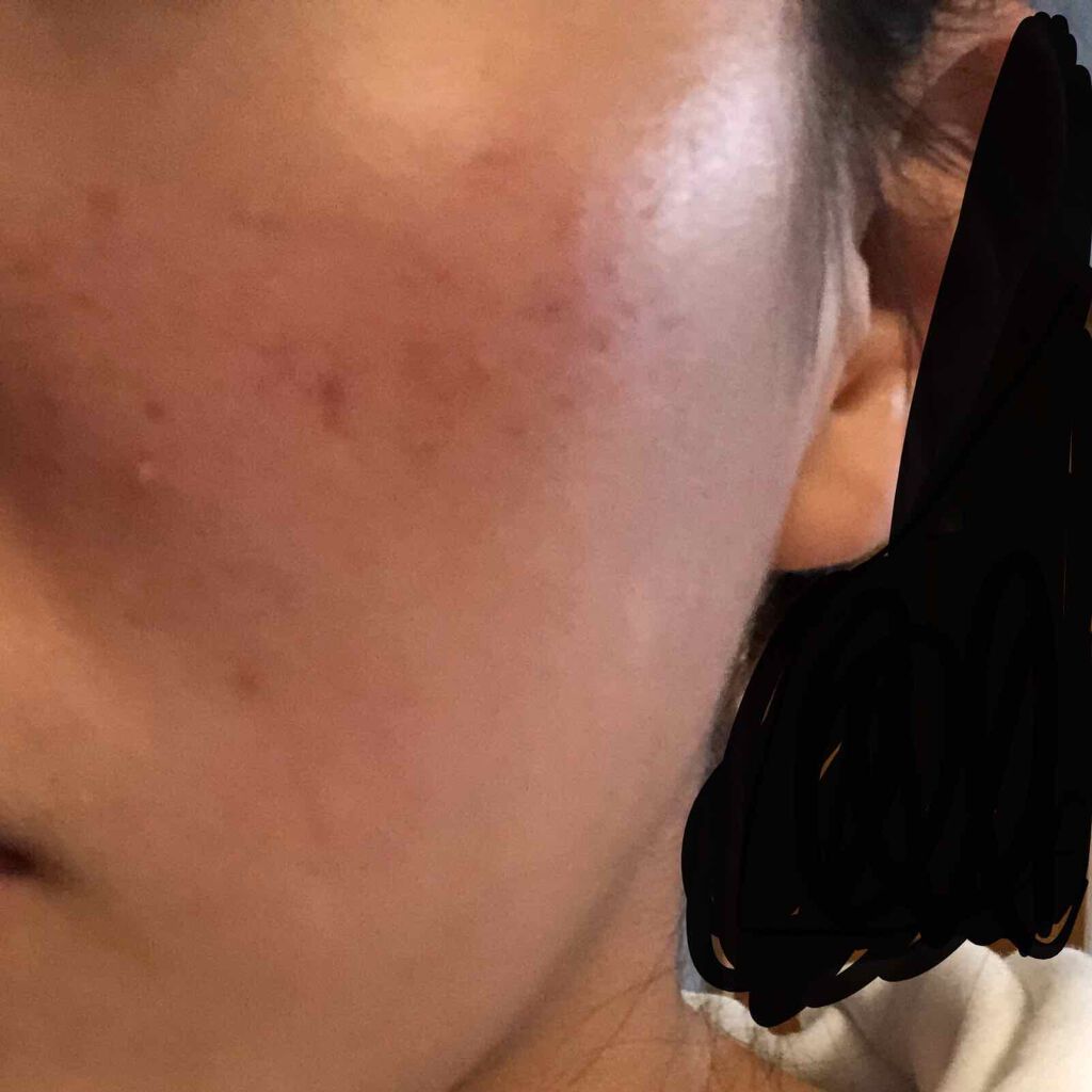 てあん on LIPS 「2,3枚目汚いです!スクロール注意!┈┈┈┈┈┈┈┈┈┈┈┈┈..」(3枚目)