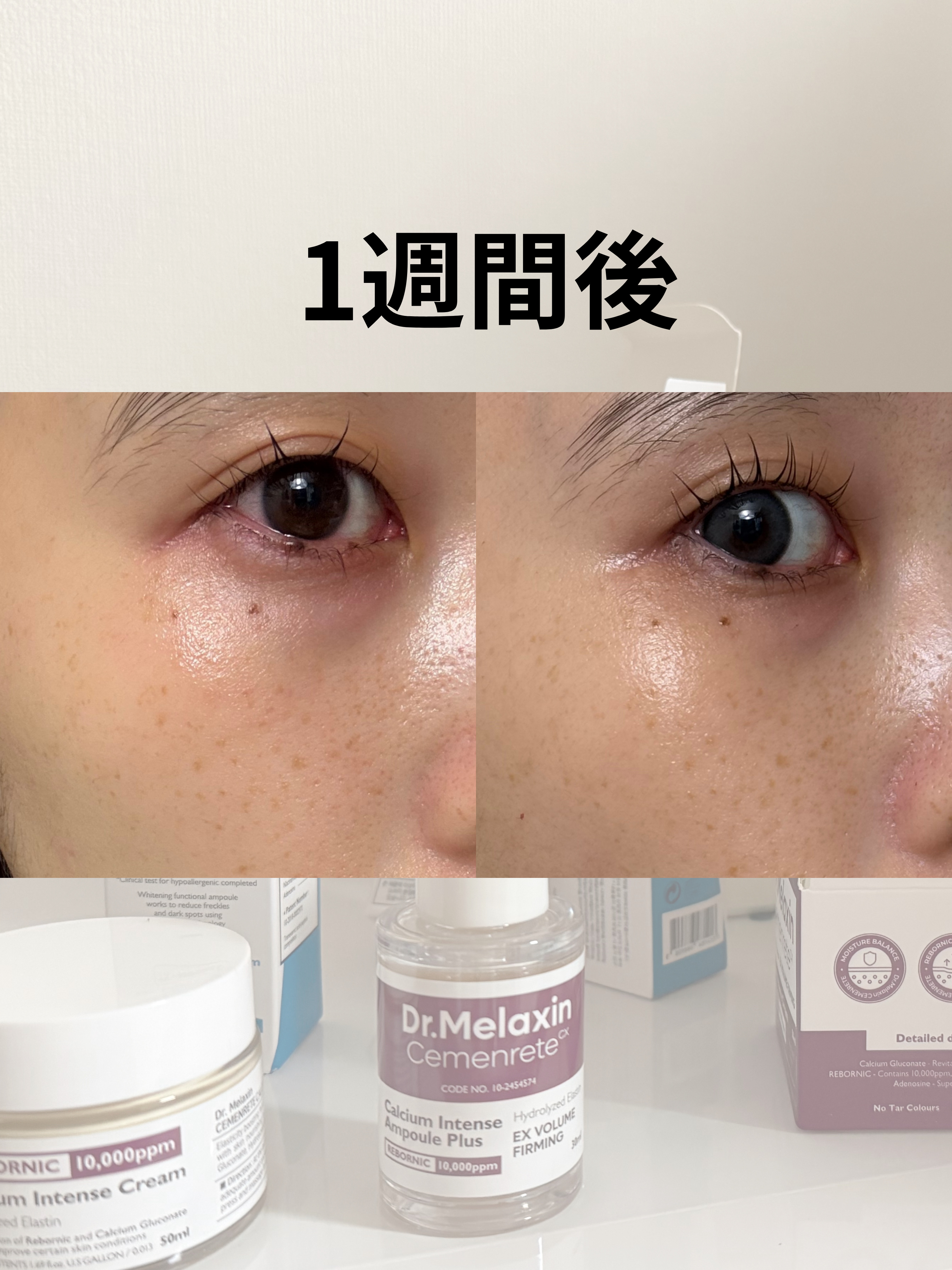 TX - AMPOULE Rx/Dr.Melaxin/美容液を使ったクチコミ（1枚目）