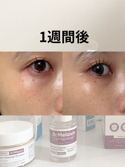 TX-Cream/Dr.Melaxin/フェイスクリームを使ったクチコミ(1枚目)