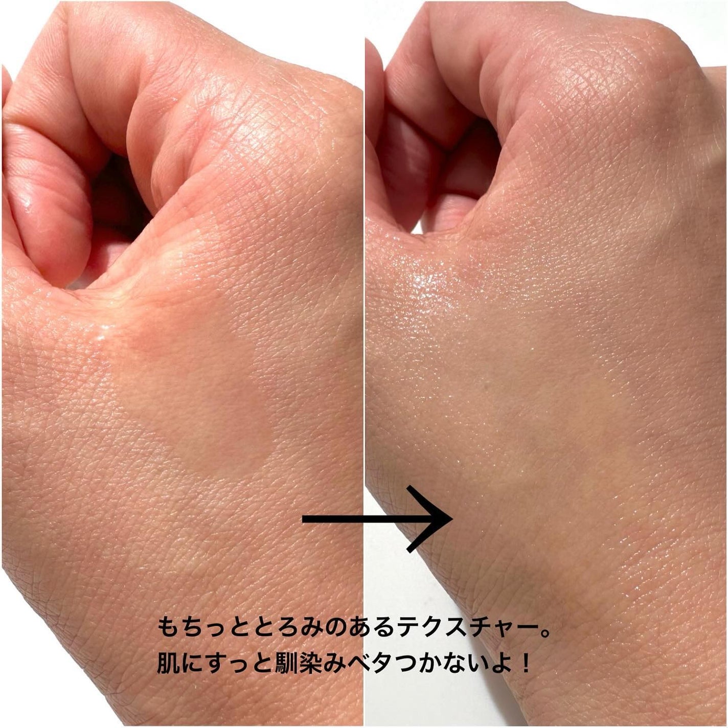 ティーツリーシカスージングトナー/BRING GREEN/化粧水を使ったクチコミ(5枚目)