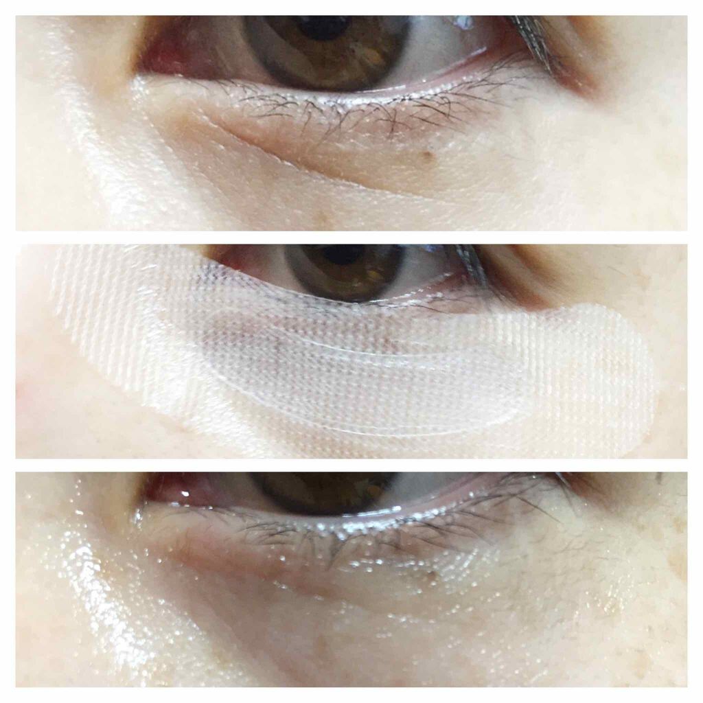 ナチュラベーレ THEマイクロニードル/ナチュラベーレ/シートマスク・パックを使ったクチコミ(4枚目)