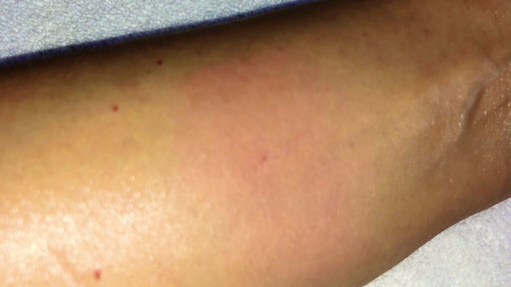 ベターザンチーク/rom&nd/パウダーチークを使ったクチコミ（3枚目）