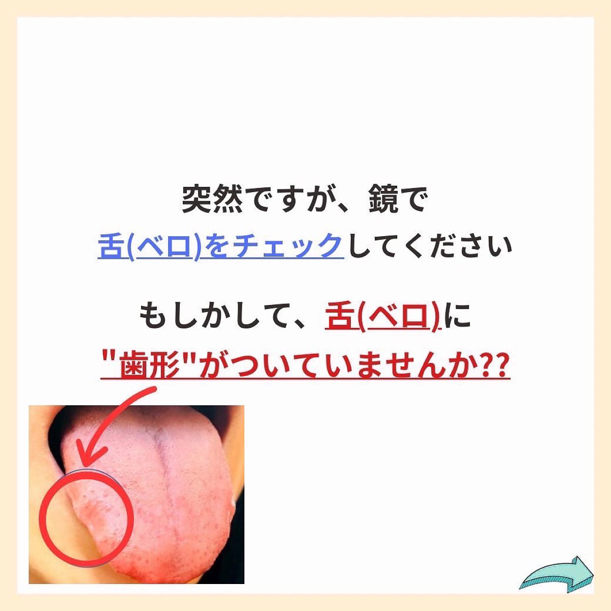 あなたの肌に合ったスキンケア💐コーくん先生 on LIPS 「【あてはまったらヤバい。】舌がこんな形の人は危険です。.
.
..」(2枚目)