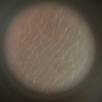 シカレチA エッセンス0.1/VT/美容液を使ったクチコミ(8枚目)