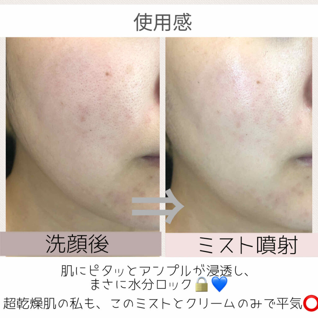 ファンダメンタルアンプルミスト(125ml)/Klairs/ミスト状化粧水を使ったクチコミ（3枚目）