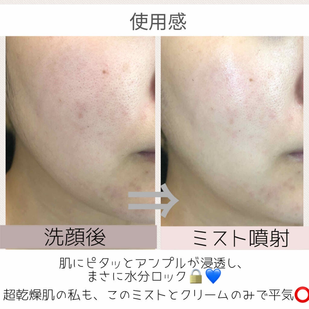 ファンダメンタルアンプルミスト(125ml)/Klairs/ミスト状化粧水を使ったクチコミ(3枚目)