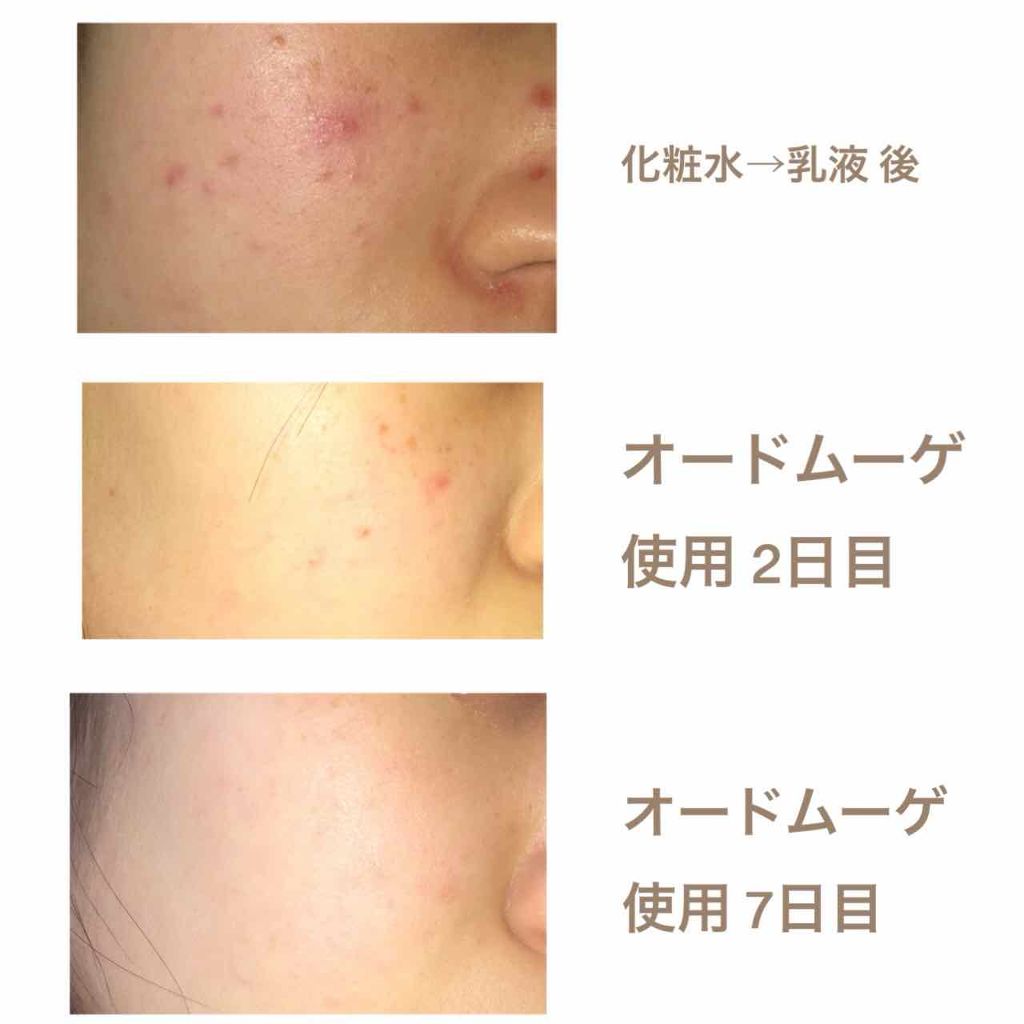 DHC ビタミンCハードカプセル/DHC/美容サプリメントを使ったクチコミ(3枚目)