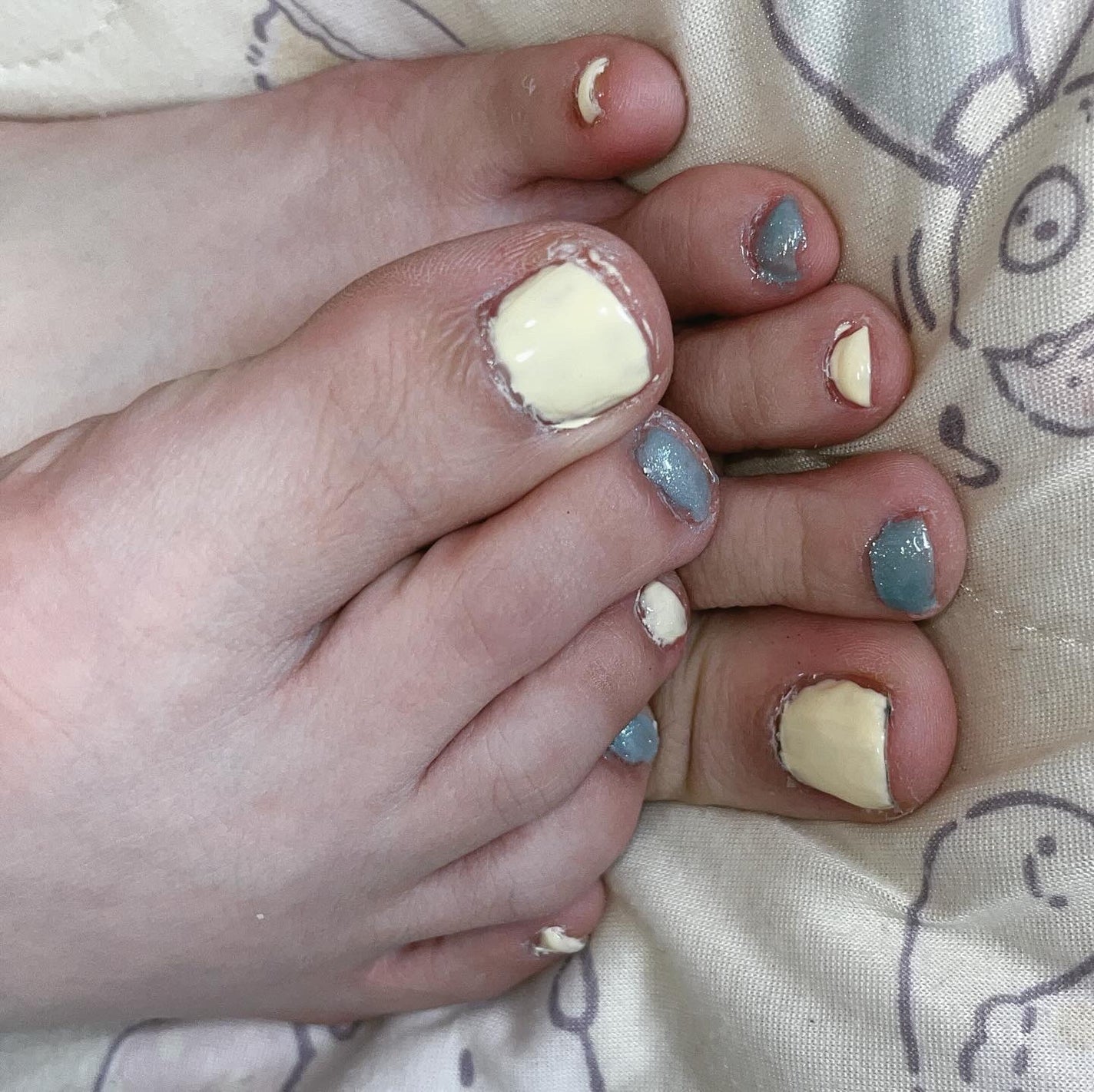 うさみみぃ@ブルベ on LIPS 「フットネイル(˙◁˙)爪が小さいから塗りにくい😂#春のフットネ..」(1枚目)