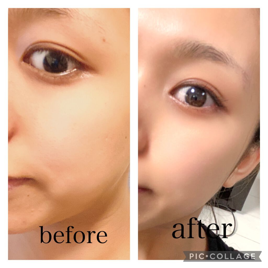 ももぷり フレッシュピールオフパック/ももぷり/ピーリングを使ったクチコミ（2枚目）