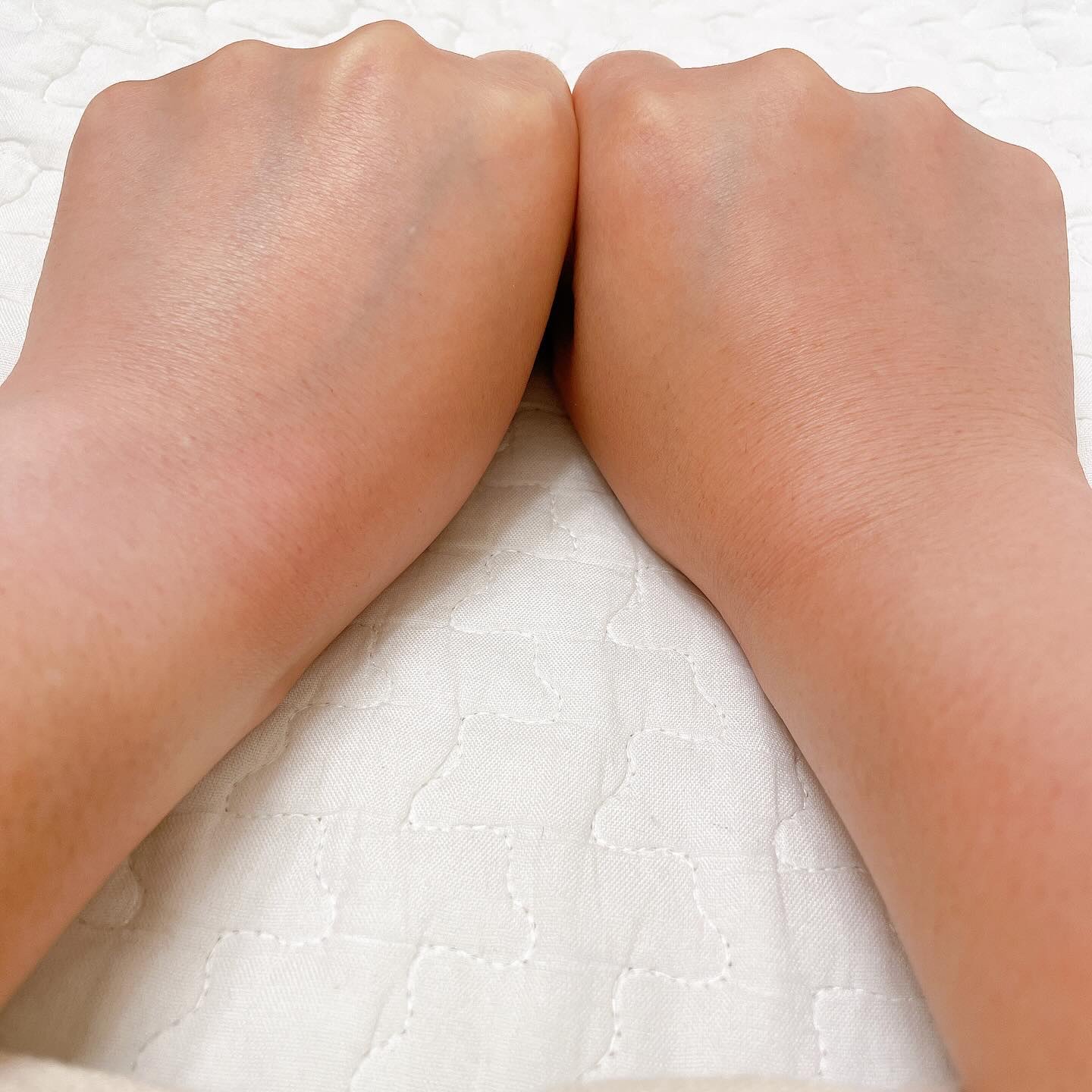 サインフォーカス ピュアアクティブ C10/エタピュール/美容液を使ったクチコミ（3枚目）