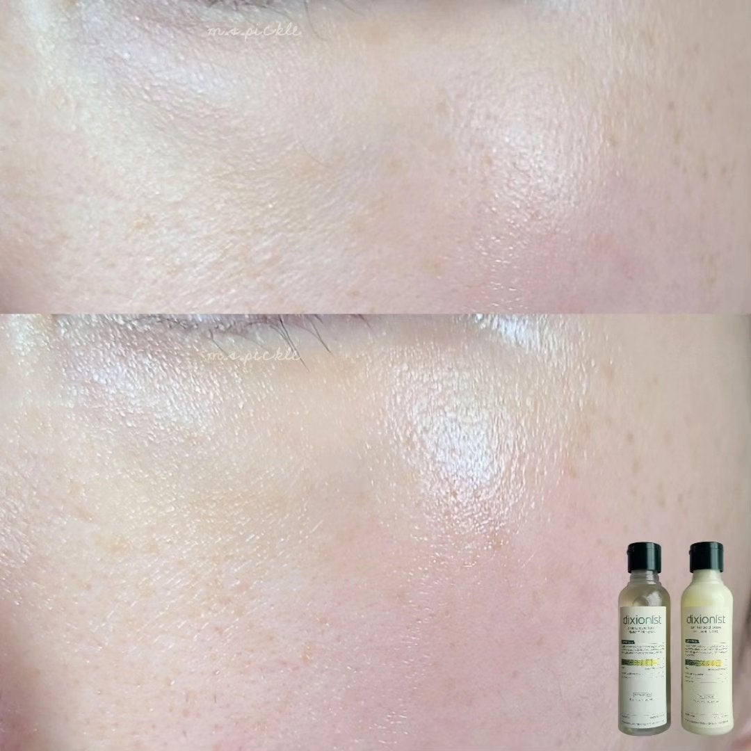 アミノ酸トナー/dixionist/化粧水を使ったクチコミ(4枚目)