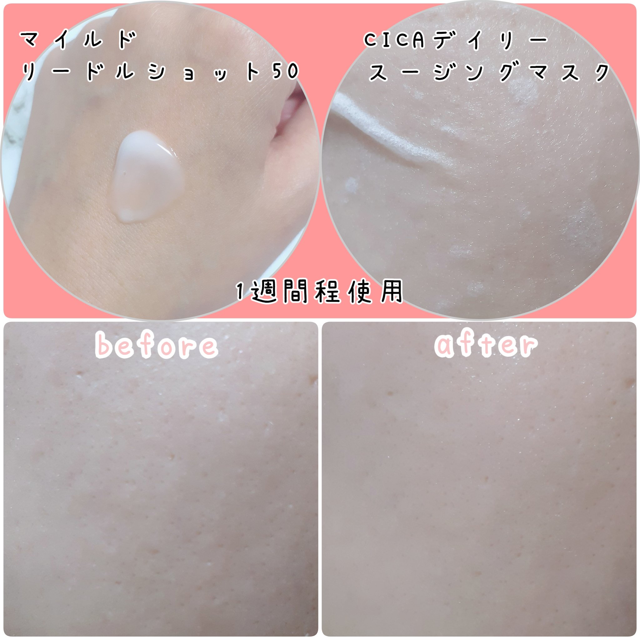 シカ レチA オールインワン 3ステップ マスク (1EA)/VT/その他スキンケアを使ったクチコミ（2枚目）