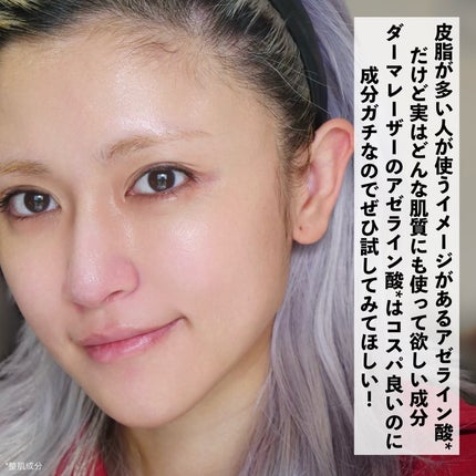 ダーマレーザー ウルセラAZ/クオリティファースト/美容液を使ったクチコミ(6枚目)