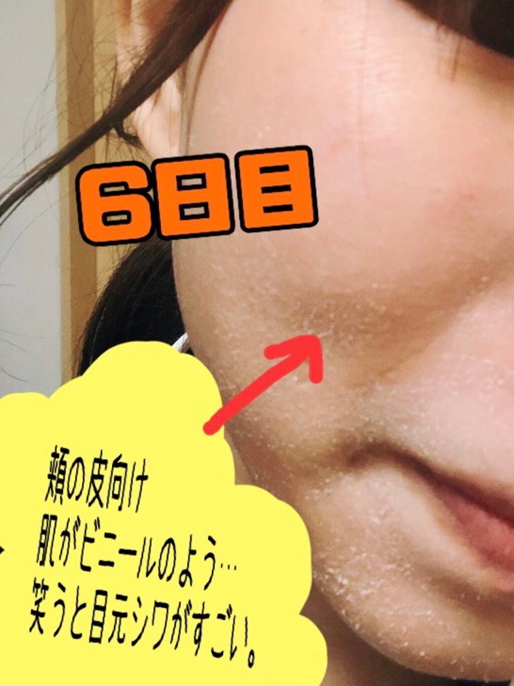 ミラミン/ZO Skin Health/フェイスクリームを使ったクチコミ(4枚目)