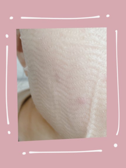 超低分子シートマスク/Isntree/シートマスク・パックを使ったクチコミ(2枚目)