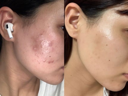 を使ったクチコミ(1枚目)