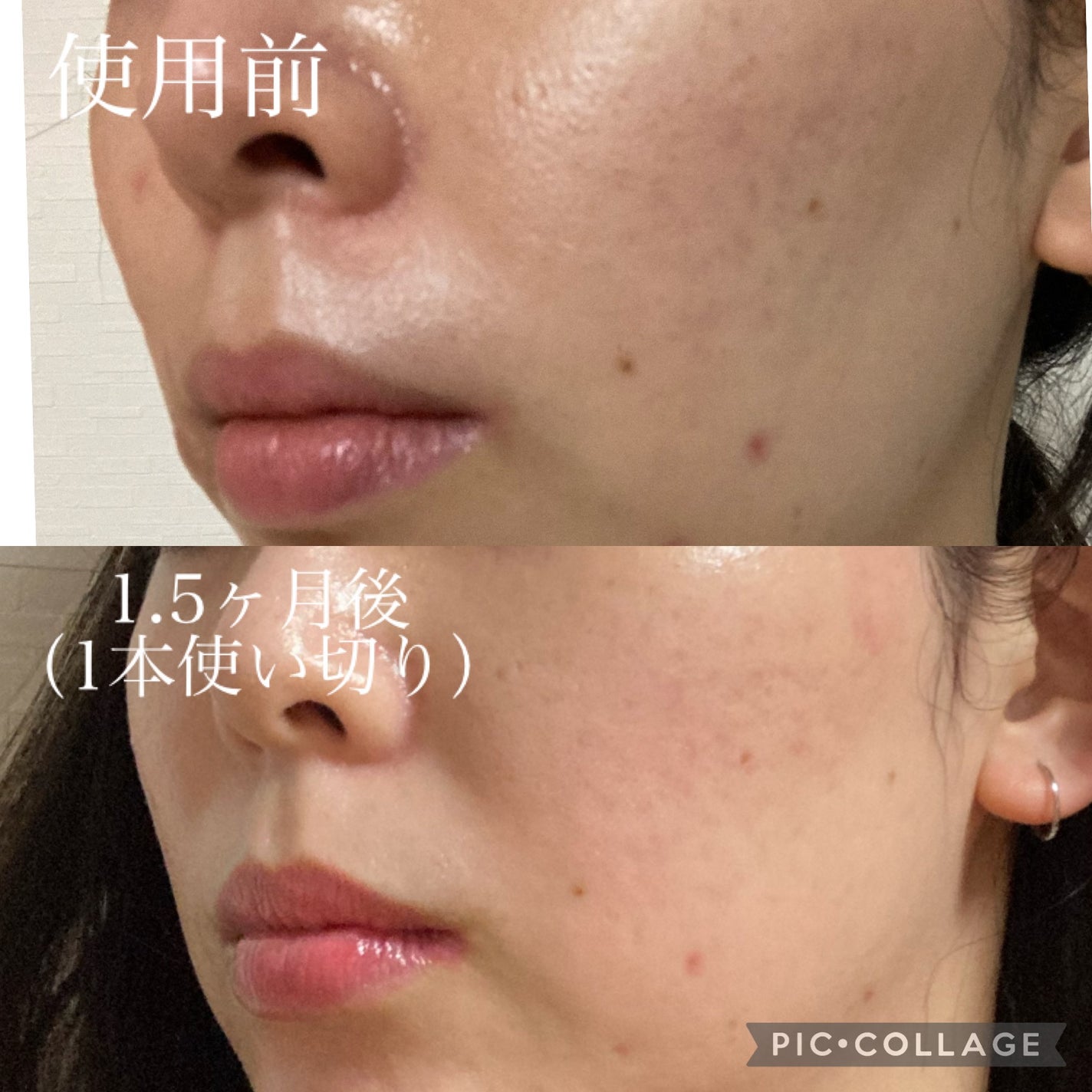 QuSomeホワイトクリーム1.9/b.glen/フェイスクリームを使ったクチコミ(3枚目)