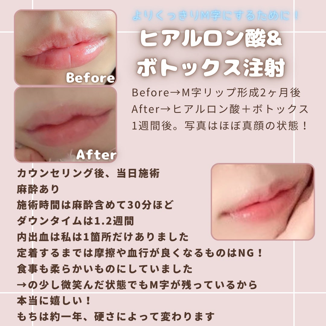 リップ オイル/DECORTÉ/リップオイルを使ったクチコミ(4枚目)