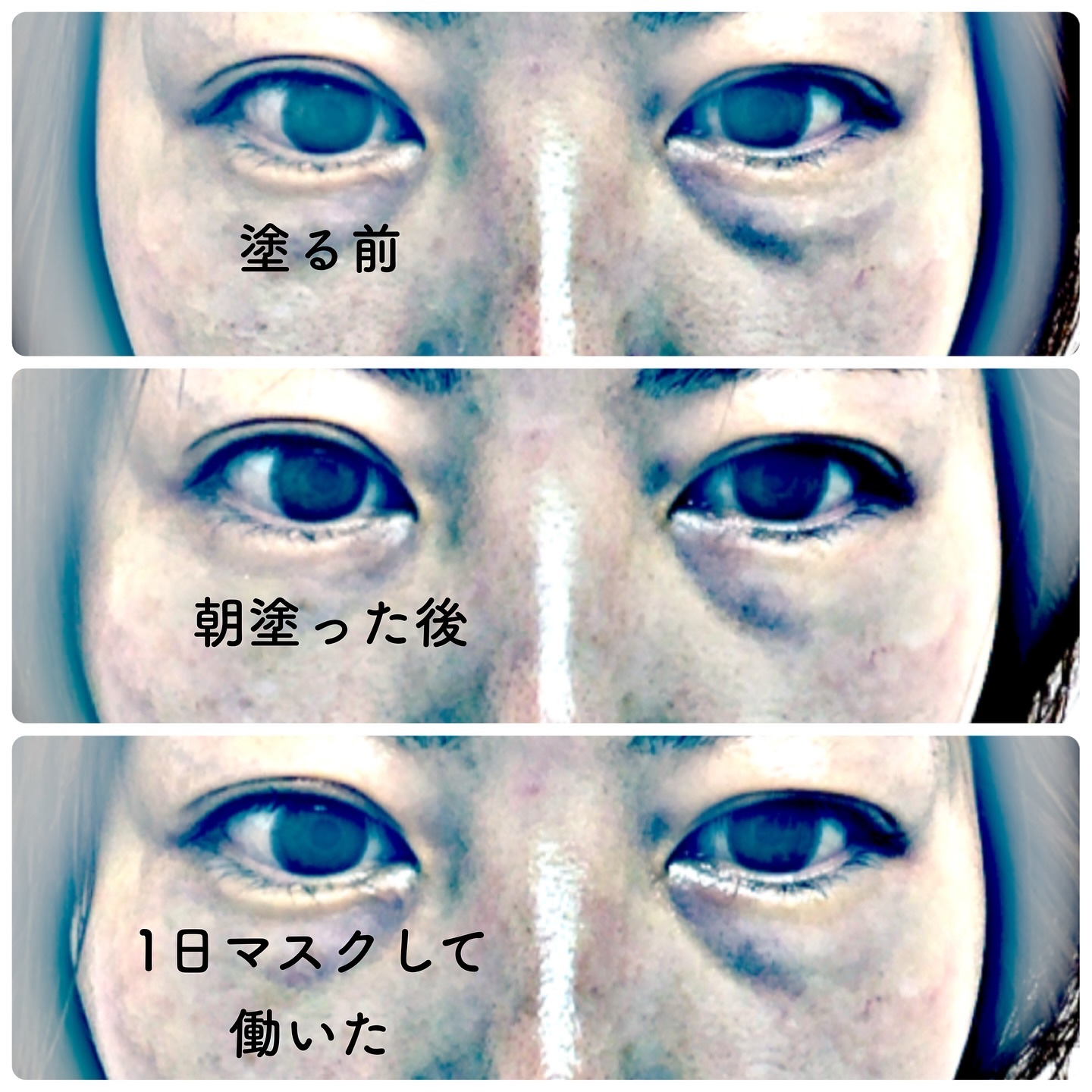 ドクターメラクチン.アイファルト アイバッククリーム Dr.Melaxin 正規取扱店 ⁄ 国内発送 アイファルト アイ