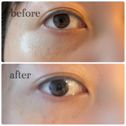 フィト バウンス アイ コントアー ソリューション/SUPEREGG /アイケア・アイクリームを使ったクチコミ(8枚目)