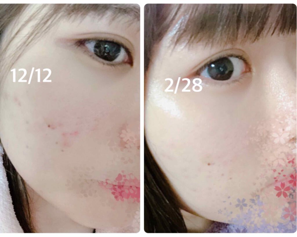 DHC はとむぎエキス/DHC/健康サプリメントを使ったクチコミ（1枚目）