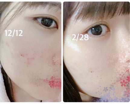 ビジャ シカバーム EX/innisfree/フェイスバームを使ったクチコミ(1枚目)