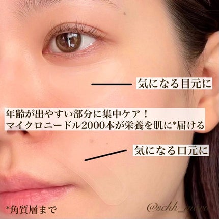 メディリフト ニードルリフトクリーム/YA-MAN TOKYO JAPAN/フェイスクリームを使ったクチコミ(2枚目)