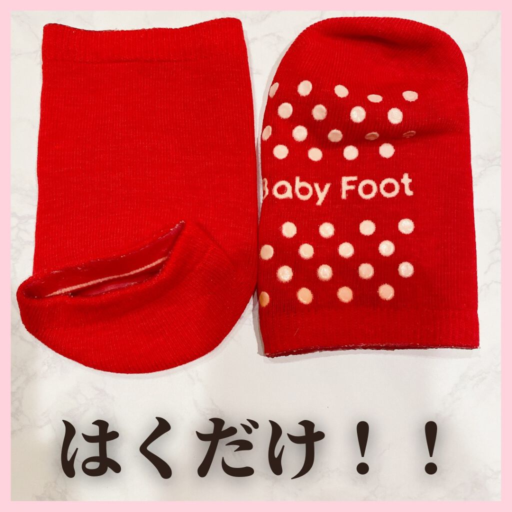 ベビーフット 保湿密封ソックス/ベビーフット/レッグ・フットケアを使ったクチコミ（1枚目）