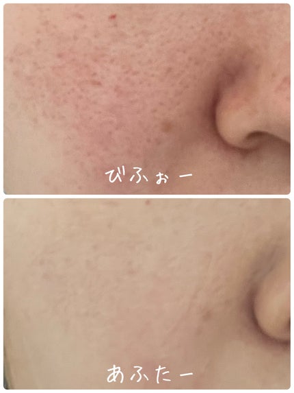 カバーアッププロコンシーラー/TFIT/パレットコンシーラーを使ったクチコミ(3枚目)