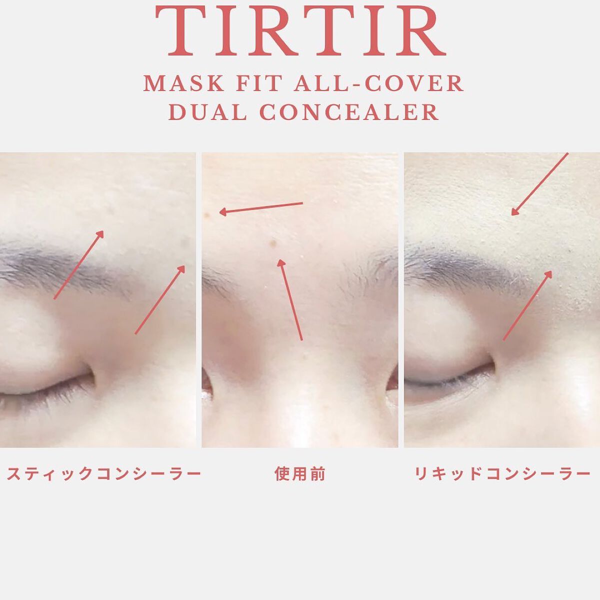 マスクフィットオールカバーデュアルコンシーラー/TIRTIR(ティルティル)/コンシーラーを使ったクチコミ(5枚目)