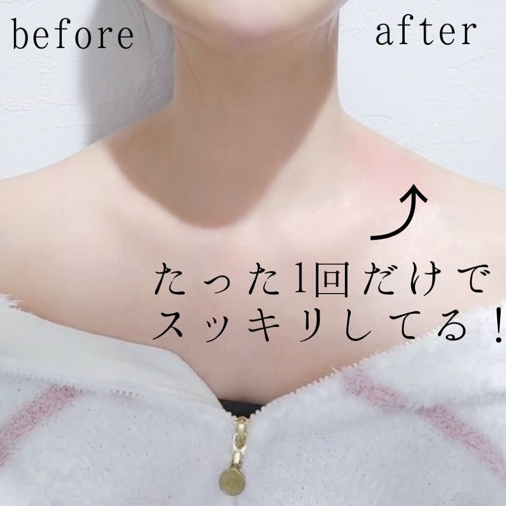 AGE-R専用ジェルセラム/MEDICUBE/美容液を使ったクチコミ(8枚目)