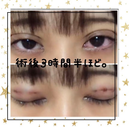 ã䜿ã£ãã¯ãã³ãïŒ2æç®ïŒ