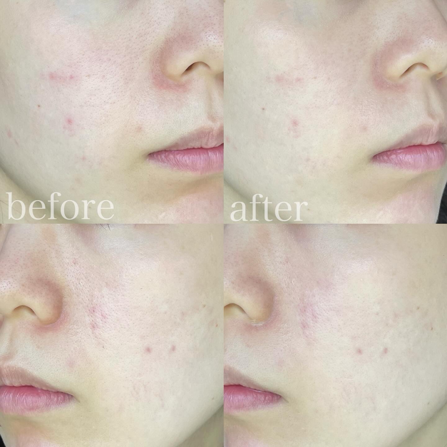 BBスキンコントロールカラー /エレガンス/化粧下地を使ったクチコミ（2枚目）