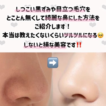 オバジ オバジC 酵素洗顔パウダーのクチコミ「【本当は教えたくない⁉️】ガチで毛穴に聞いたケアを全て紹介‼️

黒ずみ・毛穴汚れこれで撃退❣.....」（2枚目）