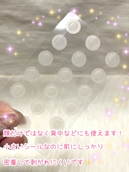 プロCICA クリアスポットパッチ/VT/その他スキンケアを使ったクチコミ(3枚目)