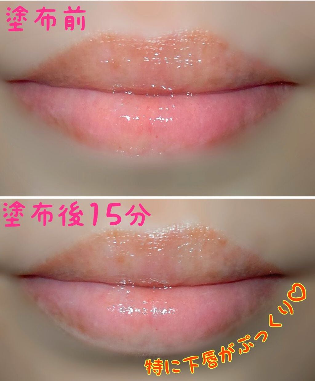 ドトムリッププラスプランパー/keybo/リッププランパーを使ったクチコミ(2枚目)