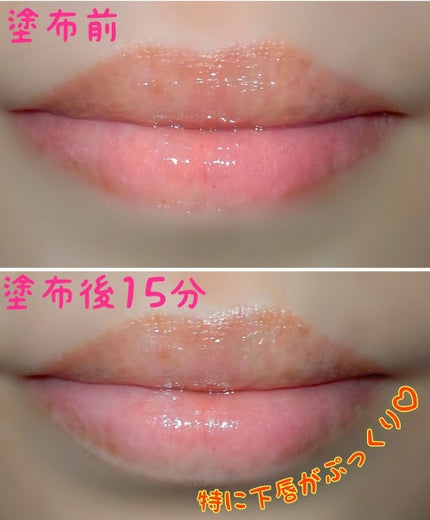 ドトムリッププラスプランパー/keybo/リッププランパーを使ったクチコミ(2枚目)