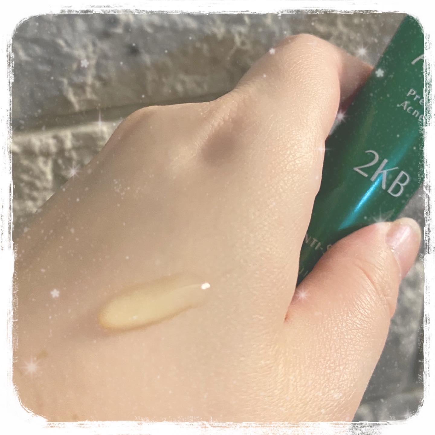 アクネアットケア/ ANTI-SIGNAL/美容液を使ったクチコミ（3枚目）