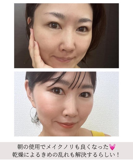 スパークリングセラムパック【YELLOW】/AKAHA/シートマスク・パックを使ったクチコミ(5枚目)