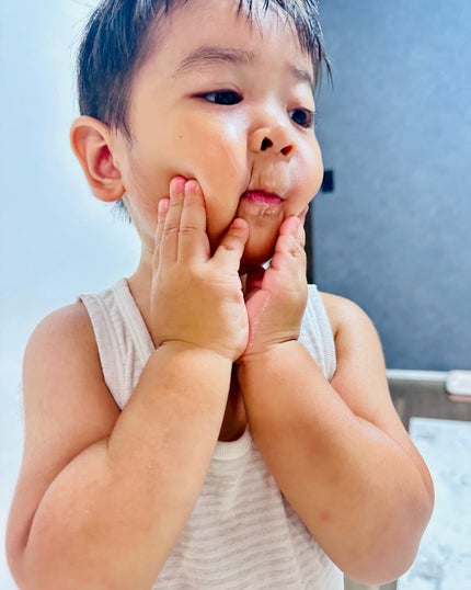 トリクセラNTフルイドクリーム/アベンヌ/ボディクリームを使ったクチコミ(3枚目)